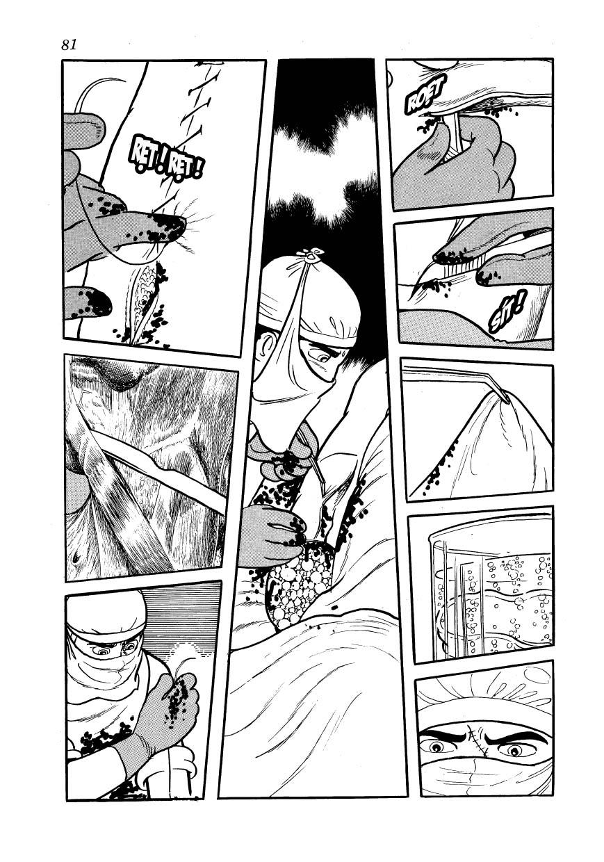 Black Jack Chap 102 - Next Chap 103