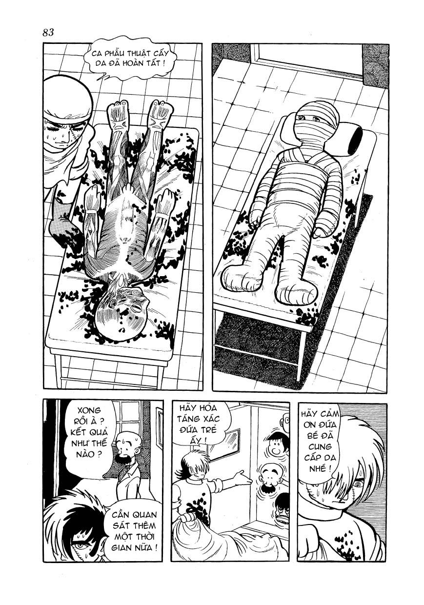 Black Jack Chap 102 - Next Chap 103