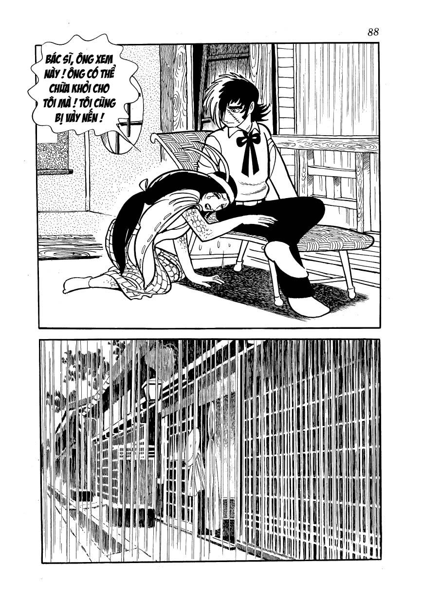 Black Jack Chap 102 - Next Chap 103