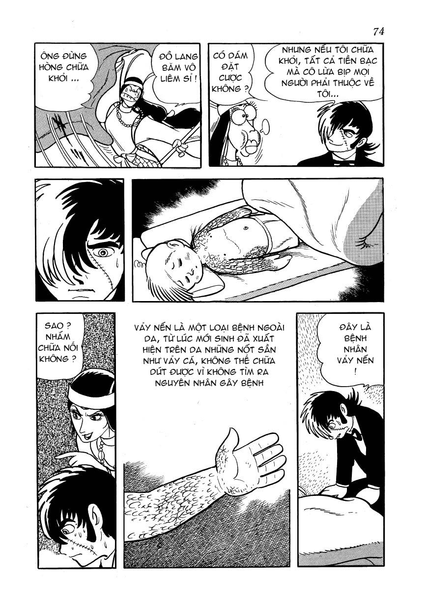 Black Jack Chap 102 - Next Chap 103