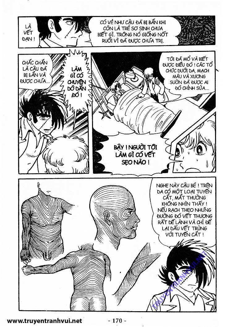 Black Jack Chap 198 - Next Chap 199