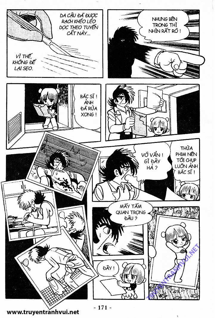 Black Jack Chap 198 - Next Chap 199
