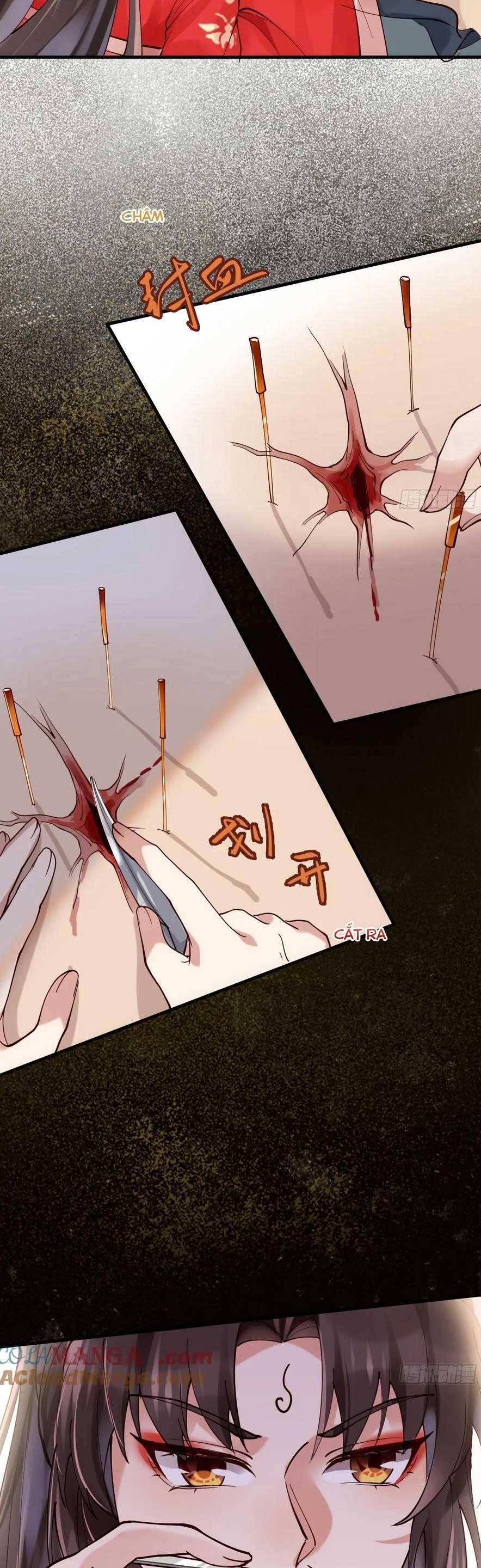 Tuyệt Sắc Quyến Rũ: Quỷ Y Chí Tôn Chap 586 - Next Chap 587